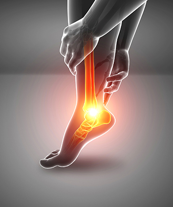 踝关节扭伤该如何治疗.jpg 踝关节扭伤该如何治疗.jpg