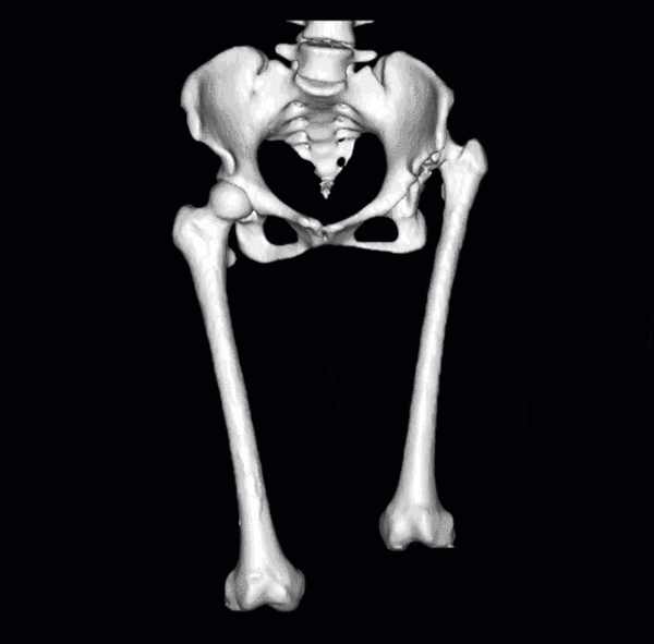 北京经开区人工智能骨科产品叩开欧洲市场大门.gif 北京经开区人工智能骨科产品叩开欧洲市场大门.gif